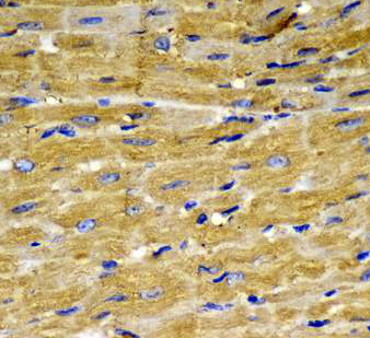 PLCG2 antibody (AB21-10139) 1-200 in IHC of Rat Brain